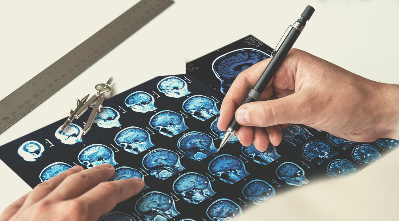 Types of Multiple Sclerosis Types of Multiple Sclerosis