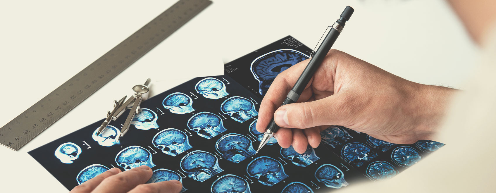 Types of Multiple Sclerosis Types of Multiple Sclerosis